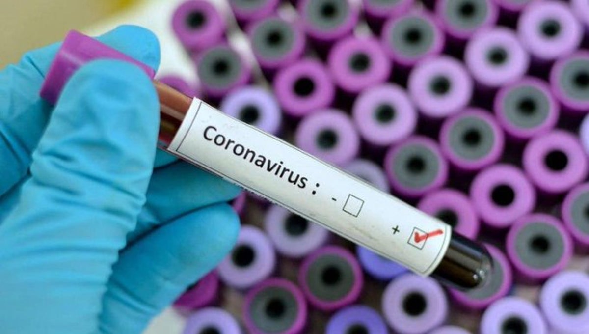 coronavirus