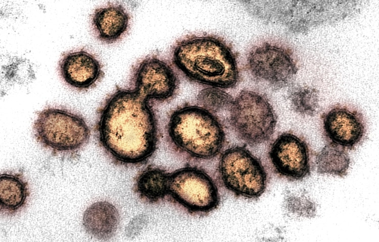 coronavirus